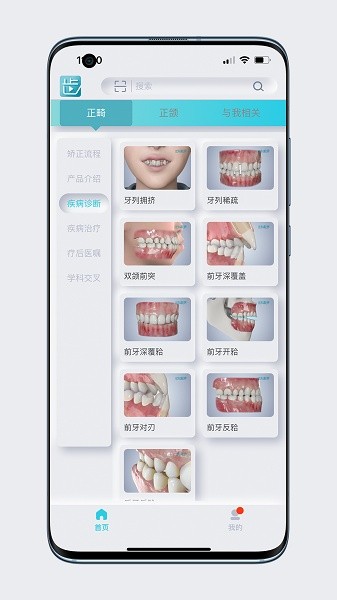 齿科视界软件下载 齿科视界下载