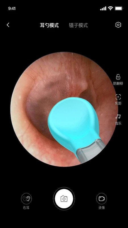 bebird挖耳勺app 蜂鸟采耳app官方下载