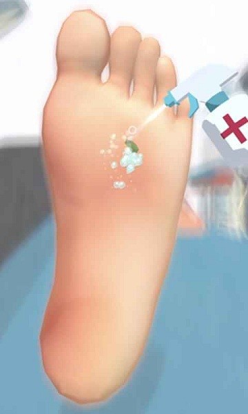 老板修个脚小游戏 老板修个脚甲沟炎下载